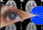 The Next Frontier for Brain Implants Is Artificial Vision